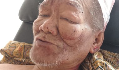 Sungguh Malang Nasib Sudirman, Pria 67 Tahun yang Dianiaya di Agam