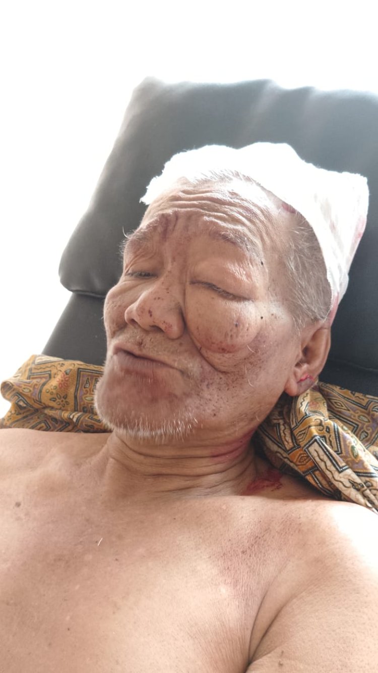 Sungguh Malang Nasib Sudirman, Pria 67 Tahun yang Dianiaya di Agam