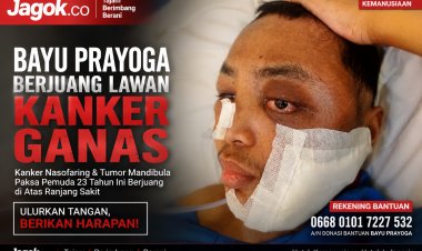 Bayu Prayoga Lawan Kanker Nasofaring dan Tumor Mandibula, Keluarga Buka Donasi untuk Biaya Pengobatan