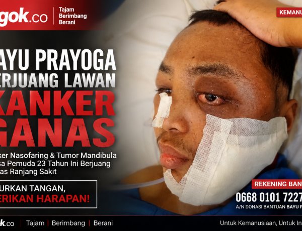 Bayu Prayoga Lawan Kanker Nasofaring dan Tumor Mandibula, Keluarga Buka Donasi untuk Biaya Pengobatan